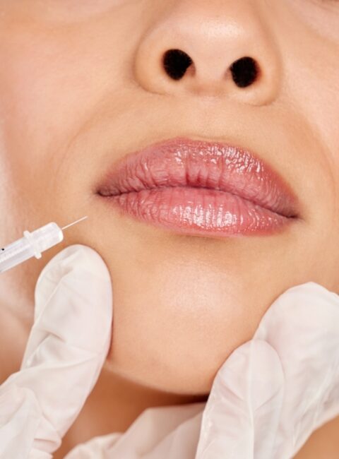 7 Secrets to Natural Dermal Filler Results